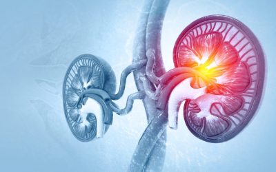 Human,Kidneys,Anatomy,Structure,,Kidney,Disease.,3d,Illustration