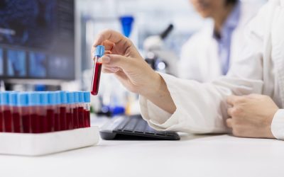 Close,Up,Of,Diagnostic,Laboratory,Manager,Looking,At,Blood,Sample